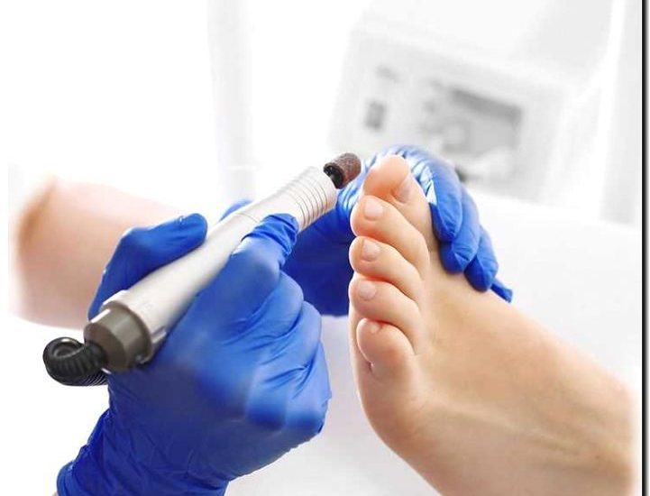 Реклама и продвижение аппаратного медицинского педикюра