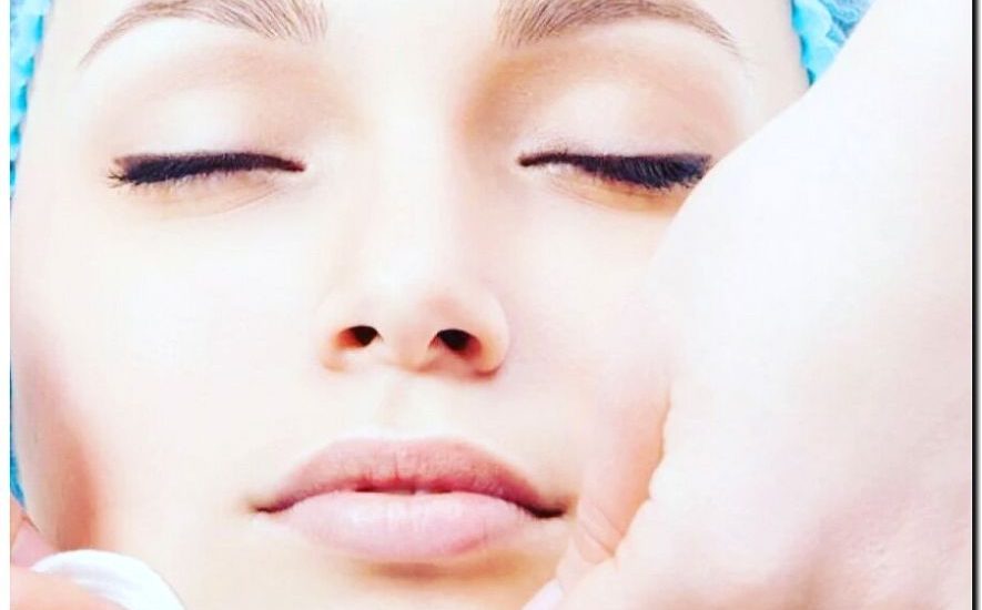 Реклама и продвижение чистки лица