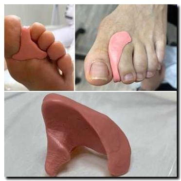 Реклама и продвижение изготовления индивидуальных ортезов