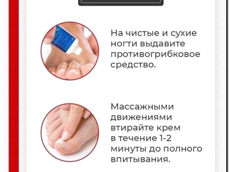 Реклама и продвижение лечения грибка ногтей