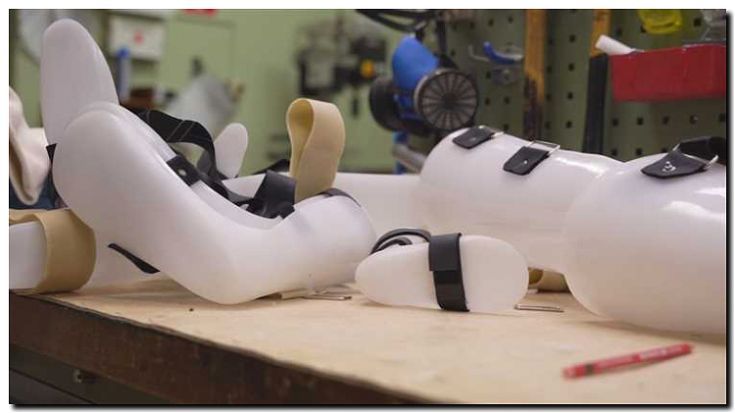 Реклама и продвижение производства ортопедических изделий и протезов