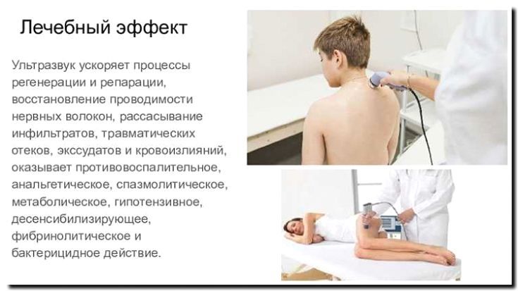 Реклама и продвижение ультразвуковой терапии